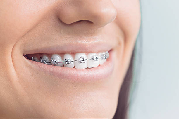 Best Invisalign and Clear Aligners  in Kill Devil Hills, NC